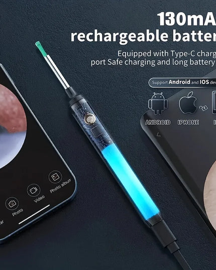 Smart Visual Ear Cleaner with 1296P Otoscope and USB-C Charging, Mini Camera Ear Wax Removal Tool and Health Care Set
