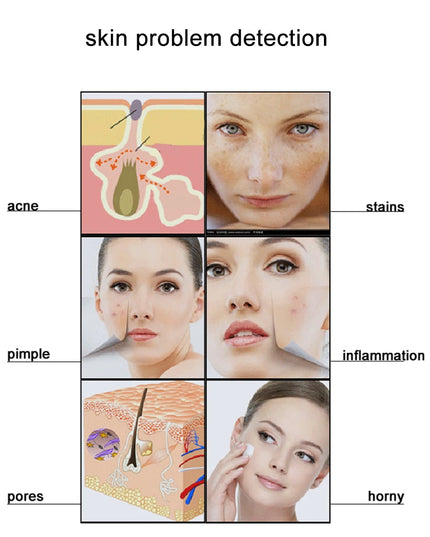 Magnifying Skin Analyzer Rechargeable Detector Hair Follicle Oil Moisture Pigment Tester Scalp/Face Skin Care Monitor 50X/200X