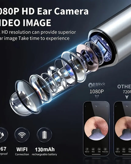 Smart Visual Ear Cleaner with 1296P Otoscope and USB-C Charging, Mini Camera Ear Wax Removal Tool and Health Care Set